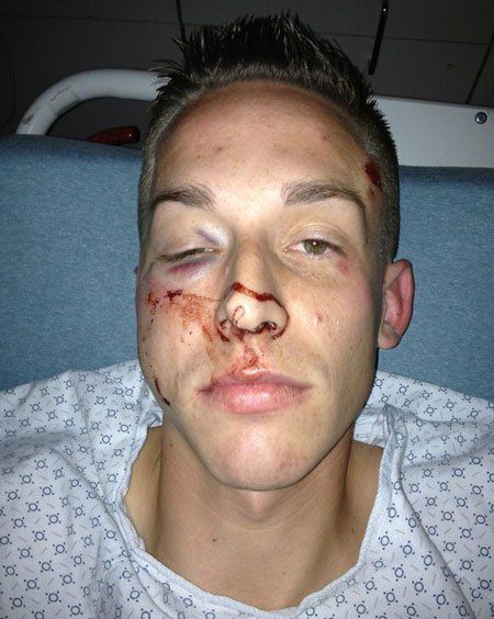 best of Photos Facial injuries