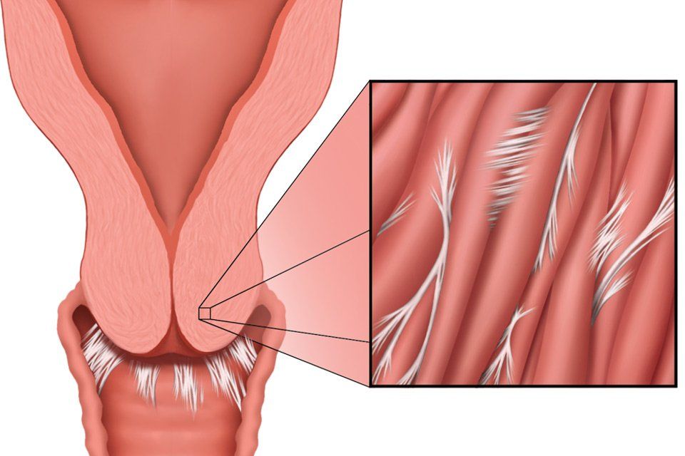 Shaved female anatomy