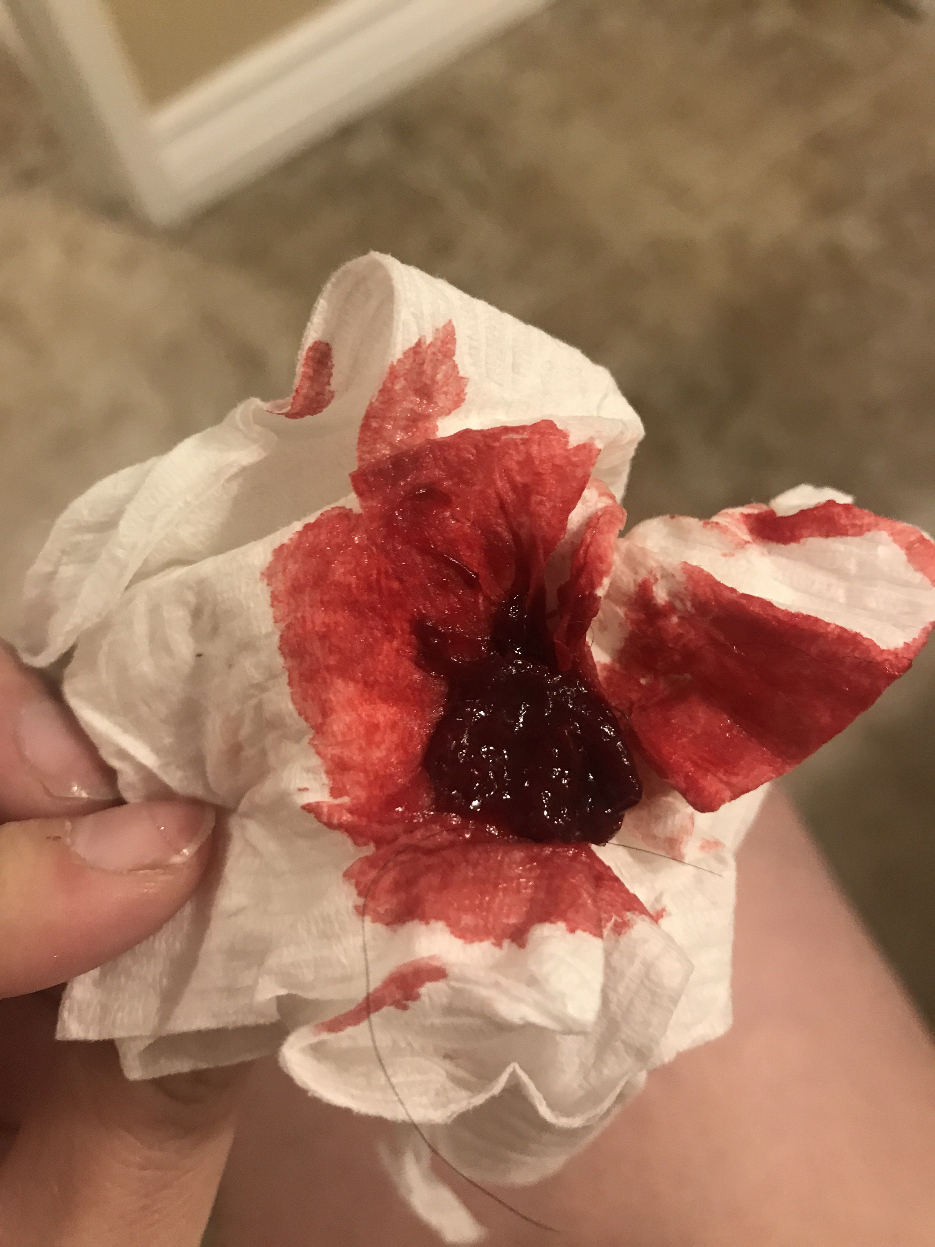 Lolli reccomend Bleeding and cramps after sex