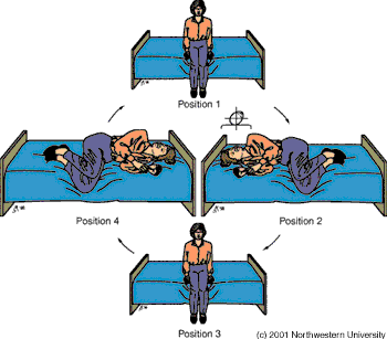 Dizziness caused by an orgasm