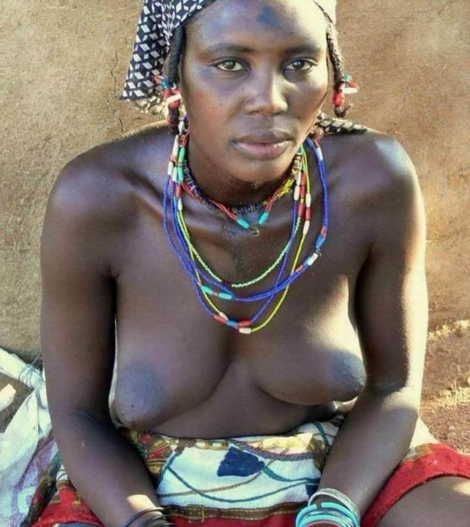 Wild K. reccomend Women naked breasts that are strange or different